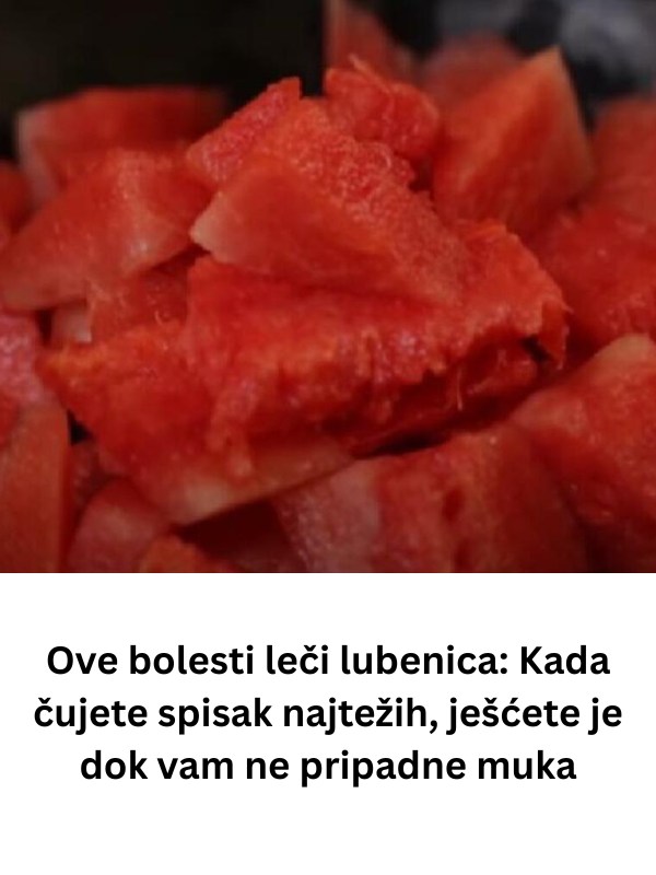 Ove bolesti liječi lubenica: Kada čujete spisak najtežih, jest ćete je dok vam ne bude muka! (FOTO) - content image