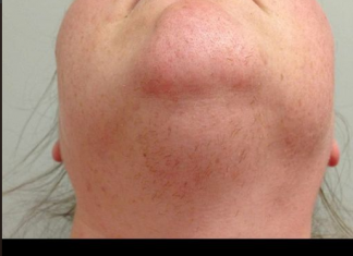 Znate li zašto ženama rastu dlake na bradi? Ovako vas vaše tijelo upozorava