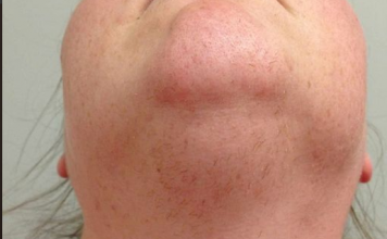 Znate li zašto ženama rastu dlake na bradi? Ovako vas vaše tijelo upozorava