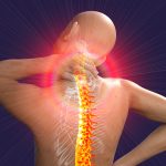 Neck,Pain,,3d,Conceptual,Illustration