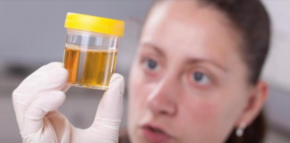 Često Mokrite Manje Količine Urina? Noću Se Budite Da Idete U Wc?