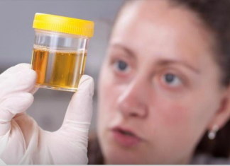 Često Mokrite Manje Količine Urina? Noću Se Budite Da Idete U Wc?