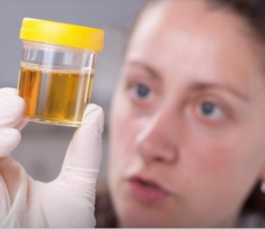 Često Mokrite Manje Količine Urina? Noću Se Budite Da Idete U Wc?