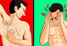 VAŠE TIJELO VAM ŠALJE UPOZORENJE: 12 znakova da jedete previše šećera SHVATITE OZBILJNO! Broj 5 nikako ne zanemarujte!