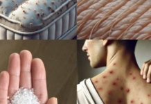 Male bube koje žive u vašem krevetu – Evo kako da ih izbacite zauvek uz ovaj jednostavan trik!