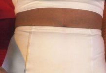 10 SIMPTOMA KOJE SVAKA ŽENA MORA ZNATI: Upozoravaju na mogući RAK JAJNIKA