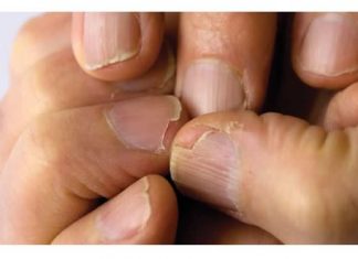 MUČE VAS UMOR, TANKA KOSA I LOMLJIVI NOKTI, EVO ŠTA VAM NEDOSTAJE U ISHRANI