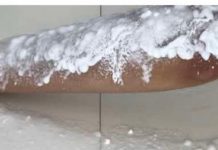 Prestanite da se brijete: Ova žena vam pokazuje TRIK kako da se riješite neželjenih dlačica na tijelu i bikiniju!