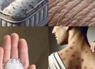 Male bube koje žive u vašem krevetu – Evo kako da ih izbacite zauvek uz ovaj jednostavan trik!