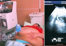 Trudna žena ima 226 kilograma i došla je na ultrazvuk, a onda je medicinska sestra podigla njen stomak i pogledala bolje… (VIDEO)