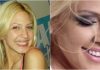 KAD SU SKUPILI PARE, URADILI SU ZUBE: POGLEDAJTE kako su izgledale domaće ličnosti PRIJE UMJETNIH ZUBA – CECA JE HIT (FOTO)