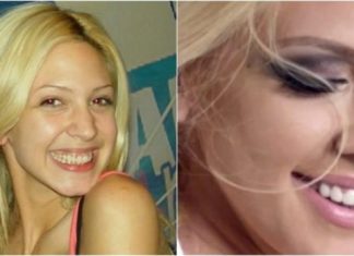 KAD SU SKUPILI PARE, URADILI SU ZUBE: POGLEDAJTE kako su izgledale domaće ličnosti PRIJE UMJETNIH ZUBA – CECA JE HIT (FOTO)