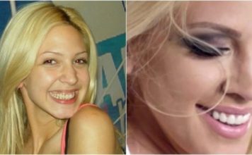 KAD SU SKUPILI PARE, URADILI SU ZUBE: POGLEDAJTE kako su izgledale domaće ličnosti PRIJE UMJETNIH ZUBA – CECA JE HIT (FOTO)
