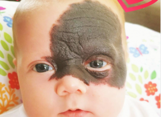 Nakon rođenja, otac od nje glavu okretao, a majka vrištala od šoka: Začudili su se da danas Natalija ovako izgleda