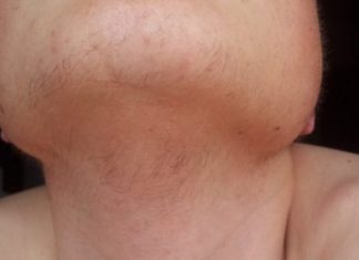 EVO ZAŠTO ŽENE IMAJU DLAKAVU BRADU! Ovo vam organizam govori!