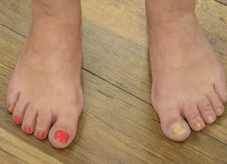 NAJBOLJI SAVJET ZA URASTAO NOKAT: Promjenu ćete osjetiti za nekoliko minuta, a djeluje i protiv modrica i gljivica!