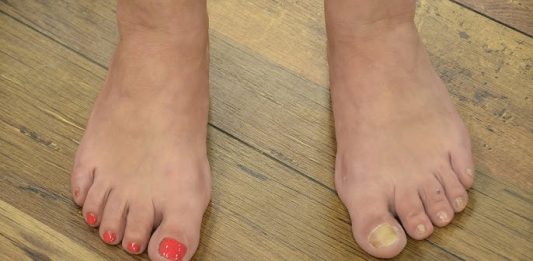 NAJBOLJI SAVJET ZA URASTAO NOKAT: Promjenu ćete osjetiti za nekoliko minuta, a djeluje i protiv modrica i gljivica!