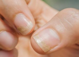 Promene na noktima ruku