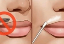 TAKO ĆETE LICE P0TPUNO BEZB0LNO RIJEŠITI RUŽNIH DLAČICA: Nećete potrošiti ni eura, a sve što vam treba već imate kod kuće