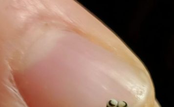 Neočekivano otkriće u salati promenilo je naše veče u restoranu.