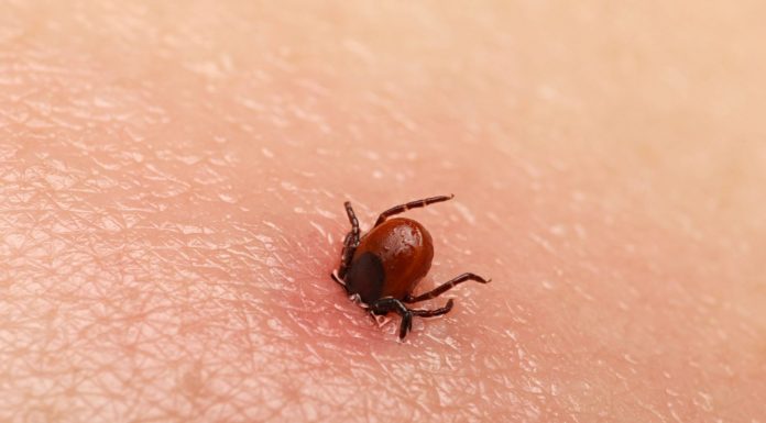 Bezbolno je i nema čupanja: Doktorka otkrila trik kako da se krpelj sam otkači sa kože (video)