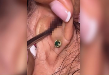 SVRBELO JE UVO DO BESVESTI, OTIŠLA U BOLNICU, A TAMO ŠOK: Kada su videli šta je unutra nisu mogli da veruju svojim očima! (FOTO)