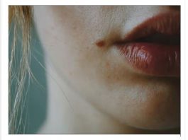 IMATE MLADEŽ IZ KOJEG RASTE DLAČICA-Evo šta to znači-Važno da znate