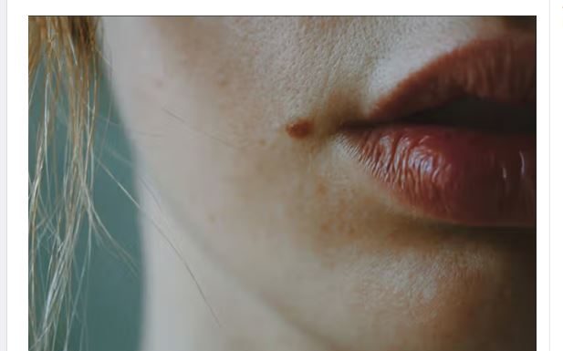 IMATE MLADEŽ IZ KOJEG RASTE DLAČICA-Evo šta to znači-Važno da znate