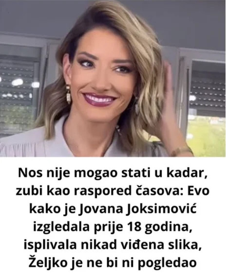 Nos nije mogao stati u kadar, zubi kao raspored časova: 0VAK0 JE Jovana Joksimović izgledala prije 18 godina! - featured image