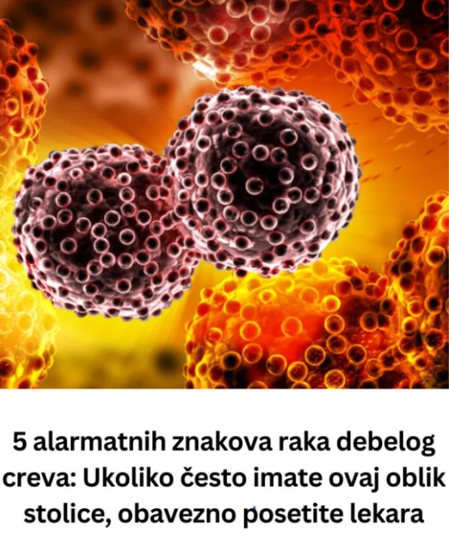 3 simptoma metastaze raka koji se javljaju rano ujutru: 0VAJ ZNAK JE crveni alaram, a svi ga zanemare … - featured image 3 simptoma metastaze raka koji se javljaju rano ujutru: 0VAJ ZNAK JE crveni alaram, a svi ga zanemare … - featured image
