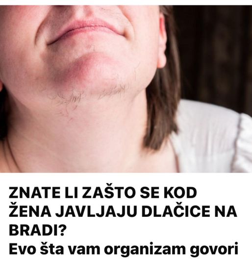 EVO ZAŠTO ŽENE IMAJU DLAKAVU BRADU! Ovo vam organizam govori! - featured image EVO ZAŠTO ŽENE IMAJU DLAKAVU BRADU! Ovo vam organizam govori! - featured image