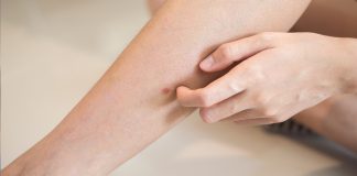 „Šta uzrokuje svrab na različitim dijelovima tijela: kada je bezopasan, a kada potražiti savjet ljekara“ „Šta uzrokuje svrab na različitim dijelovima tijela: kada je bezopasan, a kada potražiti savjet ljekara“ - featured image