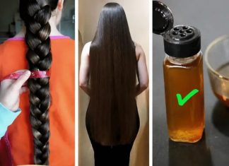 SPREČITE OPADANJE KOSE: Uz ovaj preparat kosa će rasti gušća i jača nego ikada SPREČITE OPADANJE KOSE: Uz ovaj preparat kosa će rasti gušća i jača nego ikada - featured image