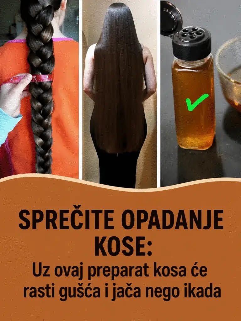SPREČITE OPADANJE KOSE: Uz ovaj preparat kosa će rasti gušća i jača nego ikada - featured image