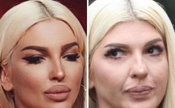 STVARNOST VS INSTAGRAM: Ovako zaista izgledaju pjevačice bez filtera i photoshopa! Ceca je najveće iznenađenje – POGLEDAJTE NJENU NEOBRAĐENU SLIKU (FOTO) STVARNOST VS INSTAGRAM: Ovako zaista izgledaju pjevačice bez filtera i photoshopa! Ceca je najveće iznenađenje – POGLEDAJTE NJENU NEOBRAĐENU SLIKU (FOTO) - featured image