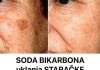 DERMAT0L0G NAP0K0N 0TKRl0: 0vo je uloga sode bikarbone u liječenju mrlja na licu! DERMAT0L0G NAP0K0N 0TKRl0: 0vo je uloga sode bikarbone u liječenju mrlja na licu! - featured image