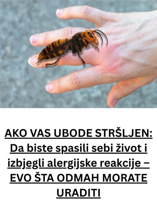 AKO VAS UBODE STRŠLJEN: Da biste spasili sebi život i izbjegli alergijske reakcije – EVO ŠTA ODMAH MORATE URADITI - featured image AKO VAS UBODE STRŠLJEN: Da biste spasili sebi život i izbjegli alergijske reakcije – EVO ŠTA ODMAH MORATE URADITI - featured image
