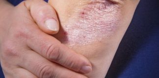 Kora banane kao kućni saveznik: od njege kože do prirodnog posvjetljivanja zuba Kora banane kao kućni saveznik: od njege kože do prirodnog posvjetljivanja zuba - featured image