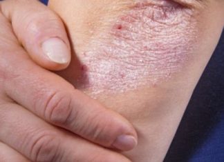 Kora banane kao kućni saveznik: od njege kože do prirodnog posvjetljivanja zuba Kora banane kao kućni saveznik: od njege kože do prirodnog posvjetljivanja zuba - featured image