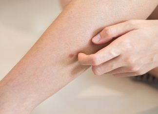 „Šta uzrokuje svrab na različitim dijelovima tijela: kada je bezopasan, a kada potražiti savjet ljekara“ „Šta uzrokuje svrab na različitim dijelovima tijela: kada je bezopasan, a kada potražiti savjet ljekara“ - featured image