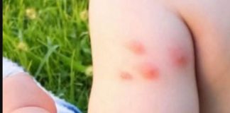 KOMARCI VAM PRAVE PAKAO OD ŽIVOTA? Samo isijecite OVO VOĆE na pola i ostavite u sobi, VIŠE IH NIKADA NEĆETE VIDJETI BLIZU! KOMARCI VAM PRAVE PAKAO OD ŽIVOTA? Samo isijecite OVO VOĆE na pola i ostavite u sobi, VIŠE IH NIKADA NEĆETE VIDJETI BLIZU! - featured image