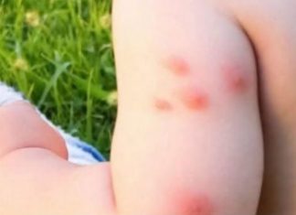 KOMARCI VAM PRAVE PAKAO OD ŽIVOTA? Samo isijecite OVO VOĆE na pola i ostavite u sobi, VIŠE IH NIKADA NEĆETE VIDJETI BLIZU! KOMARCI VAM PRAVE PAKAO OD ŽIVOTA? Samo isijecite OVO VOĆE na pola i ostavite u sobi, VIŠE IH NIKADA NEĆETE VIDJETI BLIZU! - featured image