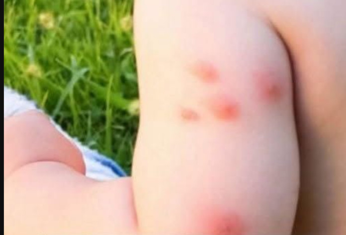 KOMARCI VAM PRAVE PAKAO OD ŽIVOTA? Samo isijecite OVO VOĆE na pola i ostavite u sobi, VIŠE IH NIKADA NEĆETE VIDJETI BLIZU! - featured image KOMARCI VAM PRAVE PAKAO OD ŽIVOTA? Samo isijecite OVO VOĆE na pola i ostavite u sobi, VIŠE IH NIKADA NEĆETE VIDJETI BLIZU! - featured image