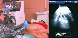 Trudna žena ima 226 kilograma i došla je na ultrazvuk, a onda je medicinska sestra podigla njen stomak i pogledala bolje… (VIDEO) Trudna žena ima 226 kilograma i došla je na ultrazvuk, a onda je medicinska sestra podigla njen stomak i pogledala bolje… (VIDEO) - featured image