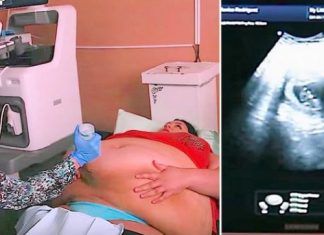 Trudna žena ima 226 kilograma i došla je na ultrazvuk, a onda je medicinska sestra podigla njen stomak i pogledala bolje… (VIDEO) Trudna žena ima 226 kilograma i došla je na ultrazvuk, a onda je medicinska sestra podigla njen stomak i pogledala bolje… (VIDEO) - featured image
