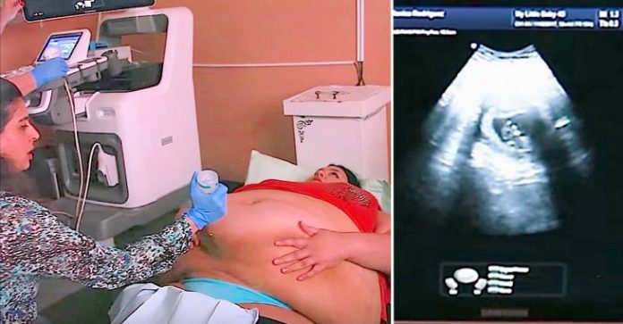 Trudna žena ima 226 kilograma i došla je na ultrazvuk, a onda je medicinska sestra podigla njen stomak i pogledala bolje… (VIDEO) - featured image Trudna žena ima 226 kilograma i došla je na ultrazvuk, a onda je medicinska sestra podigla njen stomak i pogledala bolje… (VIDEO) - featured image
