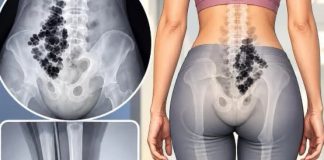 Leđa bole, noge trnu, a vi mislite da će proći? Evo šta može stajati iza toga