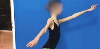 Devojčicu doveli u bolnicu, imala je samo 28 KG I RUČICE TANKE KAO GRISINE: Kad su lekari shvatili koliko ima godina, samo su se UHVATILI ZA GLAVU Devojčicu doveli u bolnicu, imala je samo 28 KG I RUČICE TANKE KAO GRISINE: Kad su lekari shvatili koliko ima godina, samo su se UHVATILI ZA GLAVU - featured image