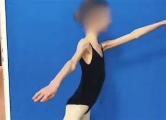 Devojčicu doveli u bolnicu, imala je samo 28 KG I RUČICE TANKE KAO GRISINE: Kad su lekari shvatili koliko ima godina, samo su se UHVATILI ZA GLAVU Devojčicu doveli u bolnicu, imala je samo 28 KG I RUČICE TANKE KAO GRISINE: Kad su lekari shvatili koliko ima godina, samo su se UHVATILI ZA GLAVU - featured image