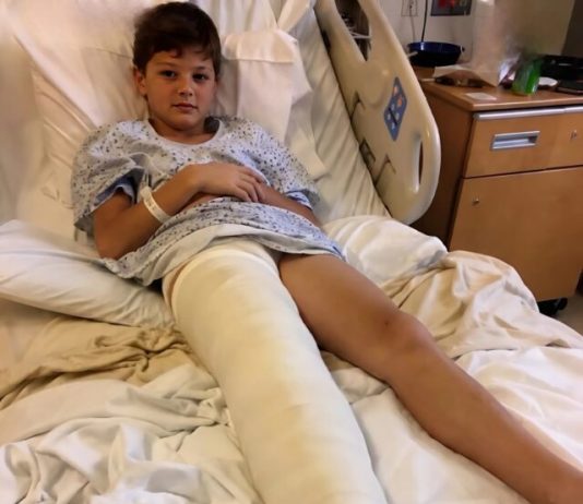 Otišla sam u bolnicu da se brinem o sinu koji je imao slomljenu nogu, ali medicinska sestra mi je krišom gurnula komadić papira u ruku i šapnula: „Laže. Provjerite kameru iz sobe u 3 ujutro.“ 😰😨 Otišla sam u bolnicu da se brinem o sinu koji je imao slomljenu nogu, ali medicinska sestra mi je krišom gurnula komadić papira u ruku i šapnula: „Laže. Provjerite kameru iz sobe u 3 ujutro.“ 😰😨 - featured image